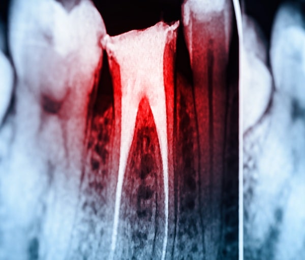 when-do-we-use-cbct-scan-regina-lakeview-dental-centre